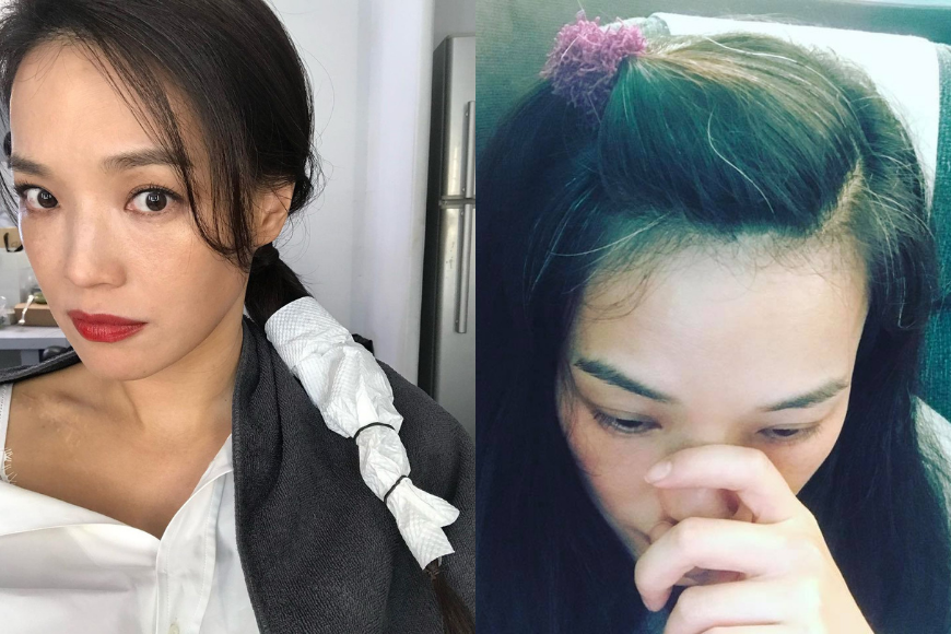 舒淇白頭髮 改善白頭髮