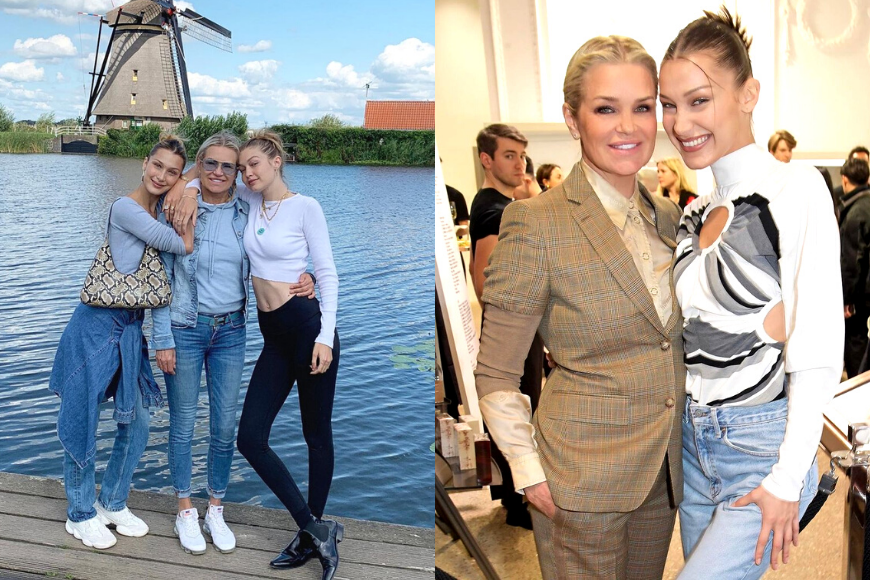 bella hadid nose plastic surgery