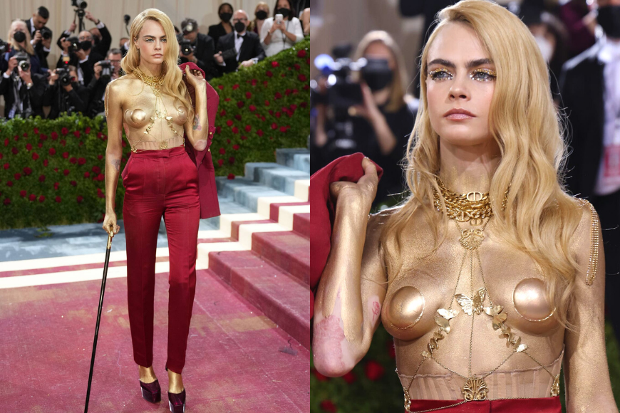 Cara Delevingne 皮膚敏感